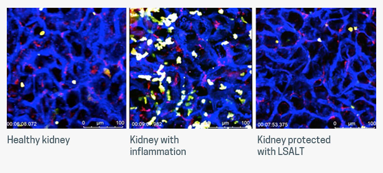 LSALT peptide was shown to prevent inflammation in pre-clinical models of AKI, similar to the inflammation found in CS-AKI